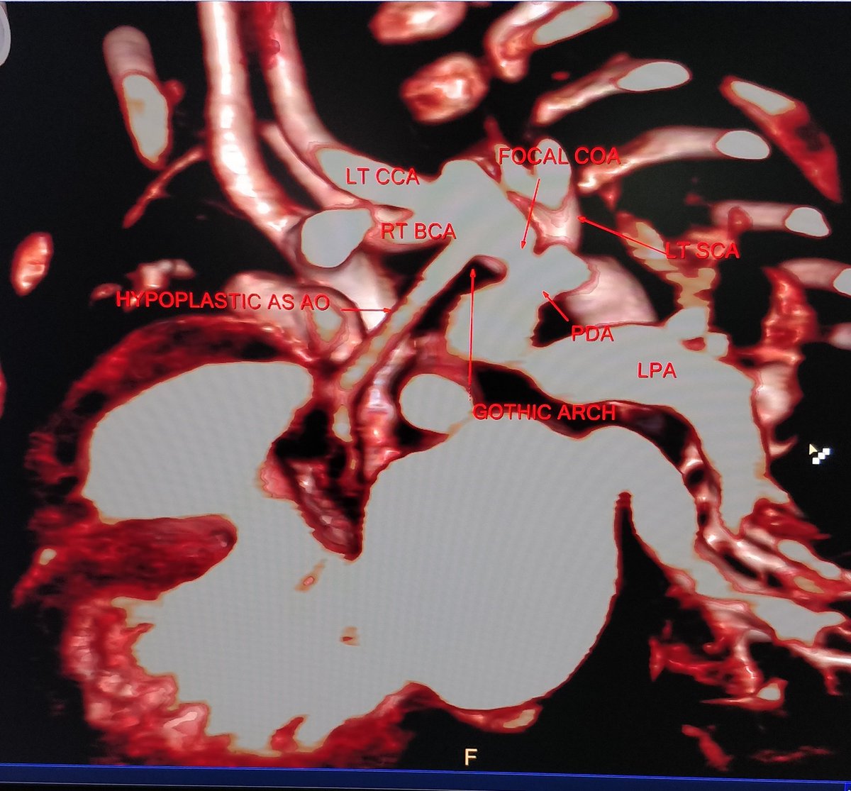 Mohamed Gibreel (@MGibreel1) tweet media