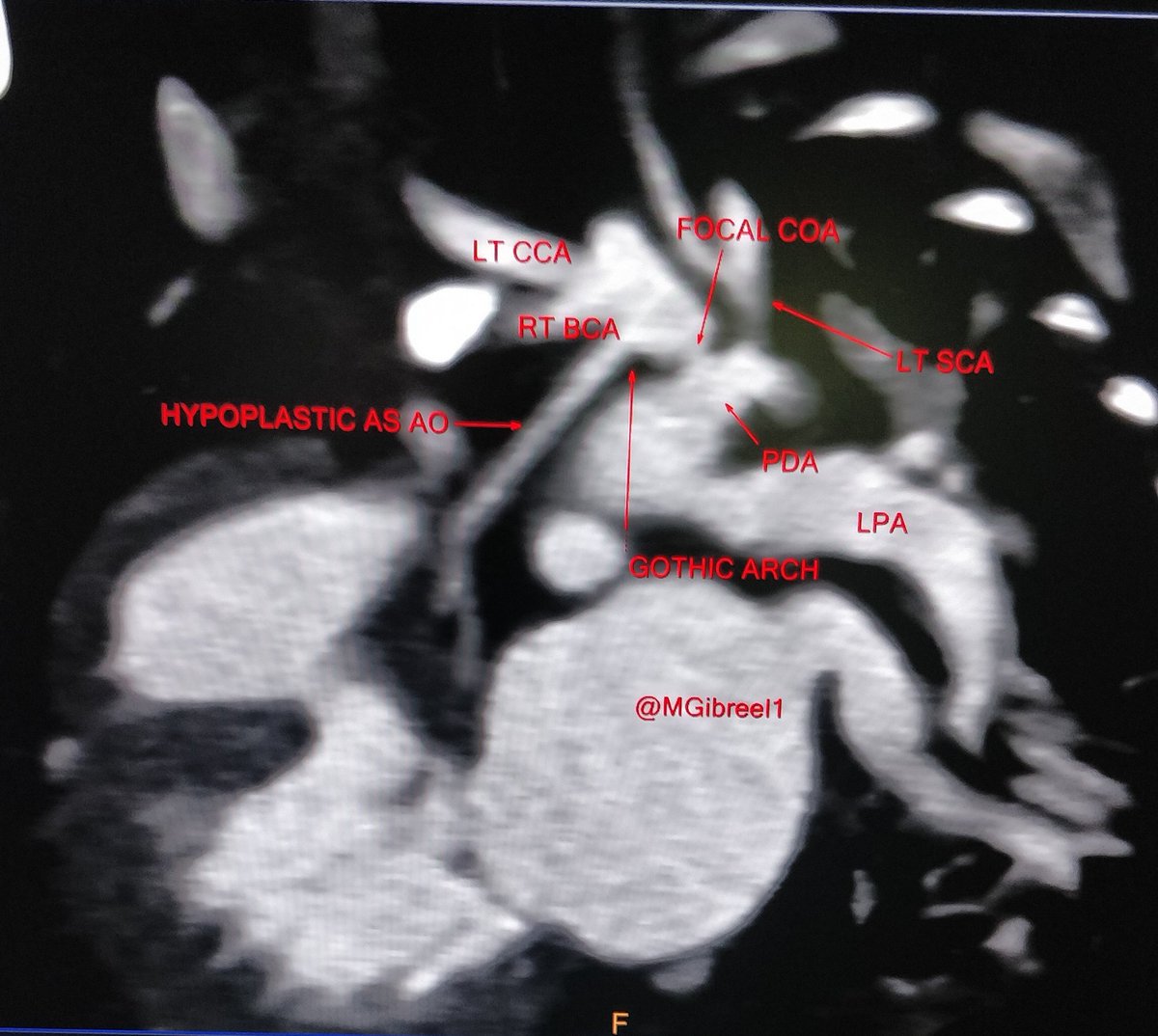 Mohamed Gibreel (@MGibreel1) tweet media