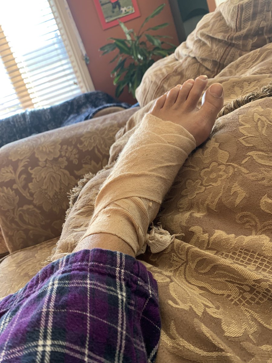 PamSidhuMahal's tweet photo. Some days not so good as others. #FootSprain #FootPain #FootRest https://t.co/swU3Kv0wc6