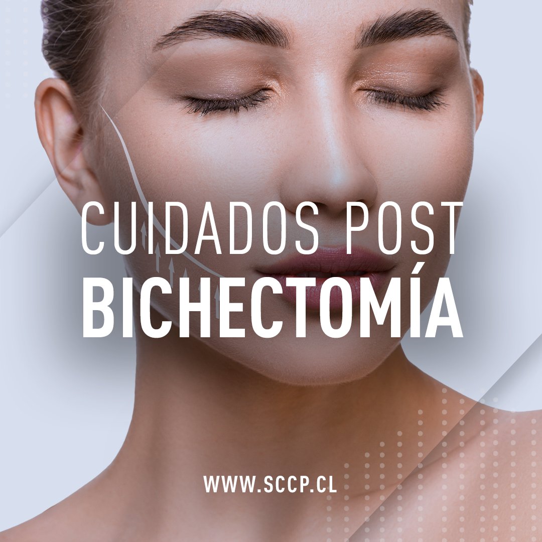sccplastica's tweet photo. ¡Te compartimos algunos cuidados que debes tener post #Bichectomía! Recuerda que este proceso debe ser realizado por un Cirujano Plástico Certificado.

Encuentra al tuyo en https://t.co/XBDY0hEKCT

 #QueTuCirujanoSeaPlástico #SCCP https://t.co/ngJXSVFJDz