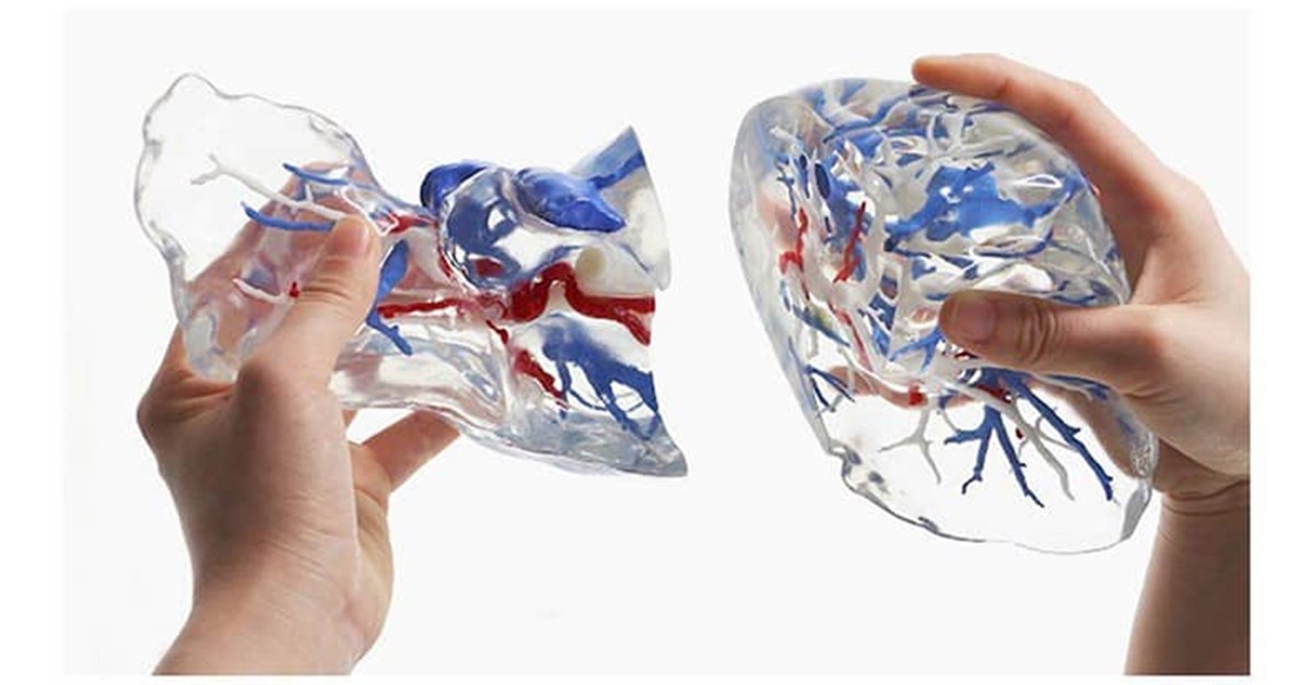 ResolutionMed's tweet image. #AdditiveManufacturing has led to major innovations within the #medicaldevice industry. For us, we&apos;ve leveraged @Carbon technology to print catheter components, client prototypes, and various other projects. @TMDmag examines the impact of this tech: buff.ly/3wtZFKW