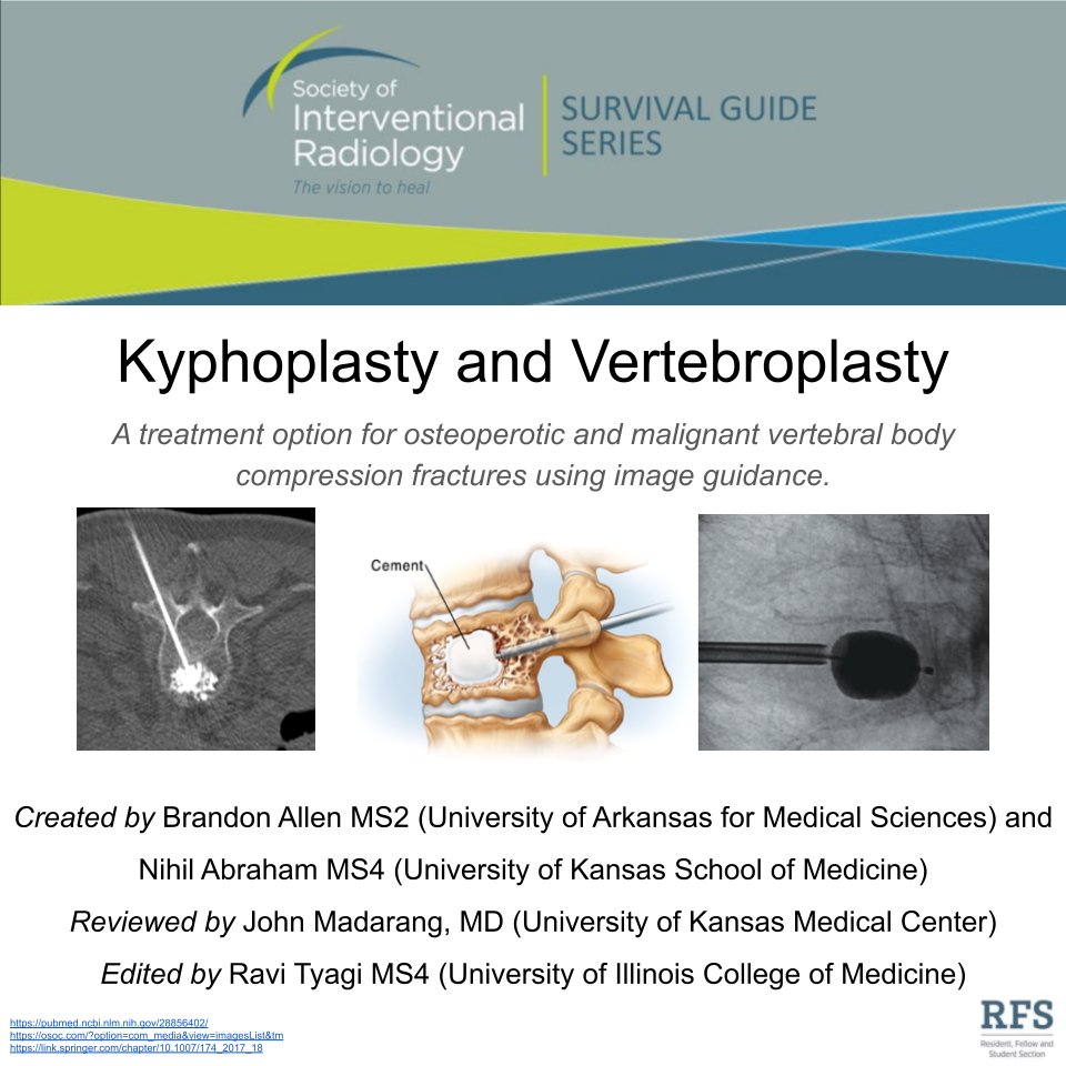 SIRRFS's tweet photo. Follow along to learn about kyphoplasty &amp; vertebroplasty! Created by Brandon Allen (@Brandon_Allen3) &amp; Nihil Abraham (@NihilAbraham). Reviewed by John Madarang, MD. Edited by Ravi Tyagi (@ravityagi200).
#TwittIR #MedEd #RadTwitter #MedTwitter #FOAMRad #IRad #IR #SIR https://t.co/tIpPgeDMu9