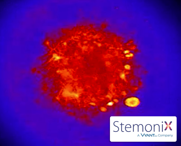 Great energy at #SfN21! Excited to spend time catching up on the latest in #stemcell research! Stop by our virtual booth to learn how we can help you on your discovery journey. Let's connect! Visit our virutal booth and reach out to info@StemoniX.com