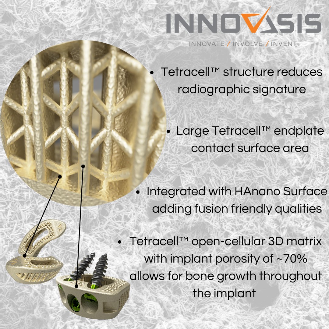 innovasis's tweet photo. Our 3D printed titanium interbody cages feature Tetracell™ structure, which is one part of what makes Innovasis the leader in BioActive Technology. Visit our website to learn more about Innovasis and why we lead BioActive Technologies. #HANANO #HAPEEK #BioActiveTechnologyLeader https://t.co/RJtRXzP20H
