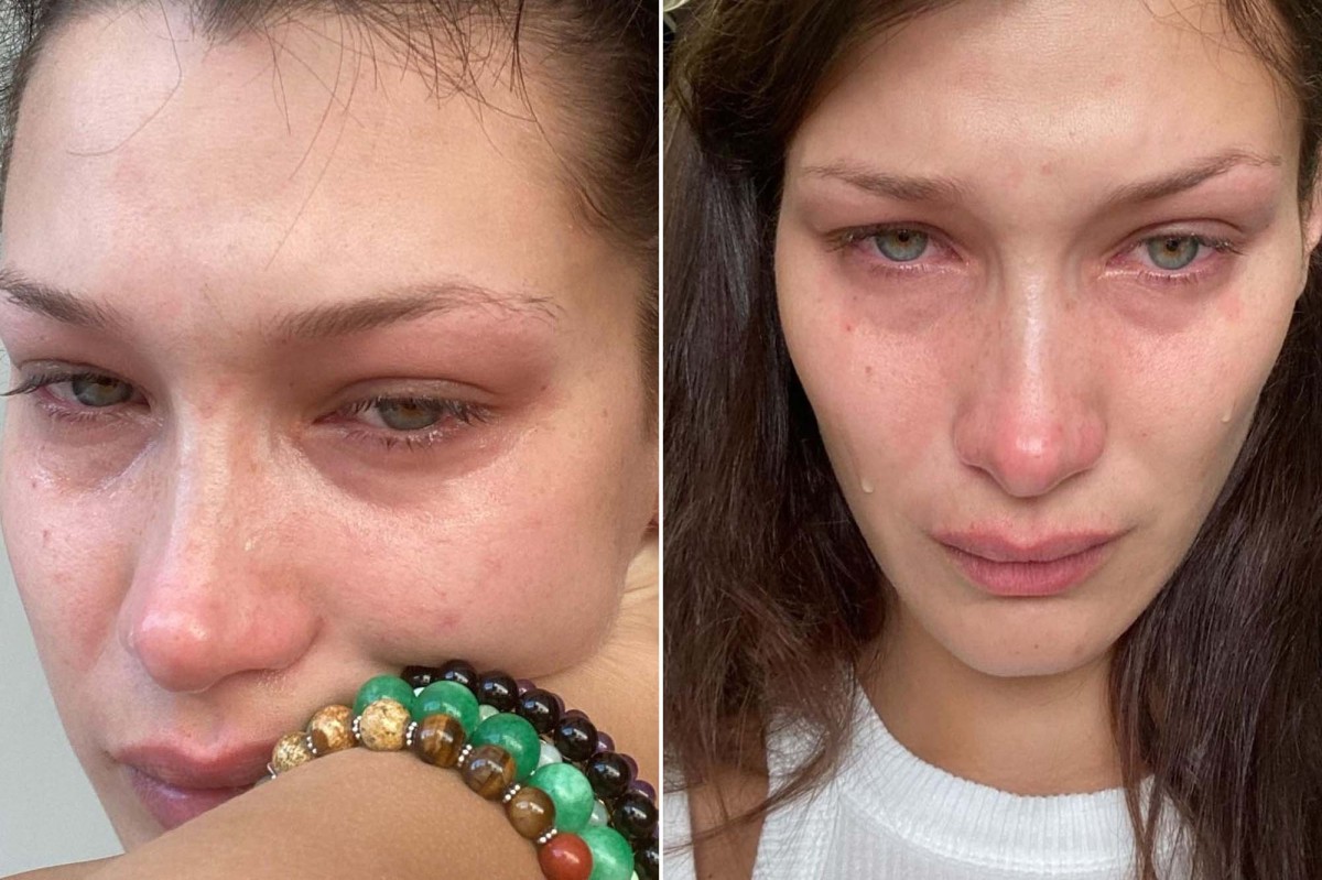 nypost's tweet photo. Bella Hadid admits she cries pretty much ‘everyday’ and ‘every night’ https://t.co/CDCVeAj5Mv https://t.co/gJ7HsVj4nQ