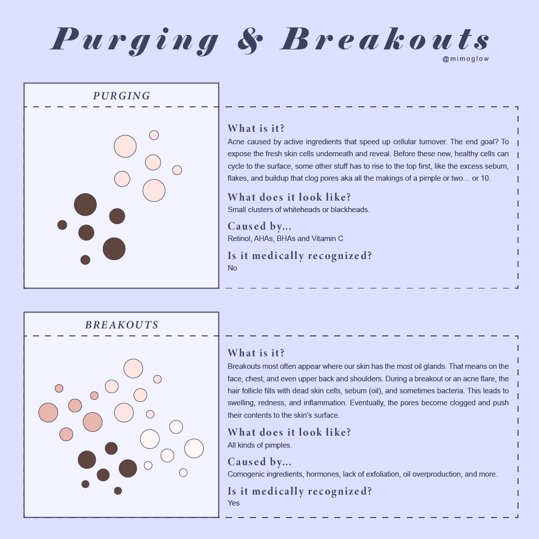Mimoglow's tweet photo. Purging is caused by active ingredients that speed up cellular turnover while a breakout or an acne flare, the hair follicle fills with dead skin cells, sebum (oil), and sometimes bacteria. ⁠ https://t.co/acVJNuwntr