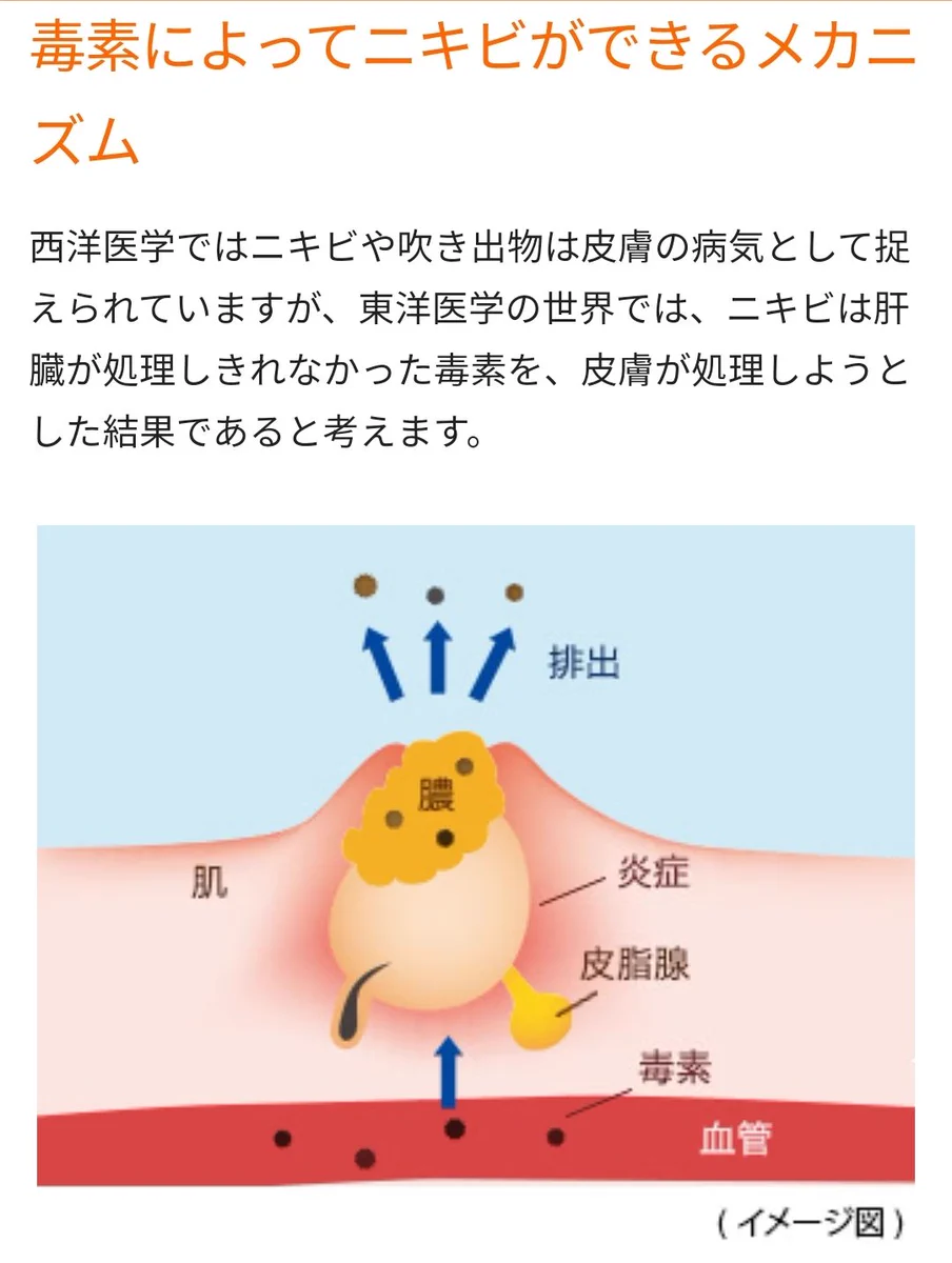 毒素によってニキビができるメカニズム！肝臓に負担がかかっている証拠かも？