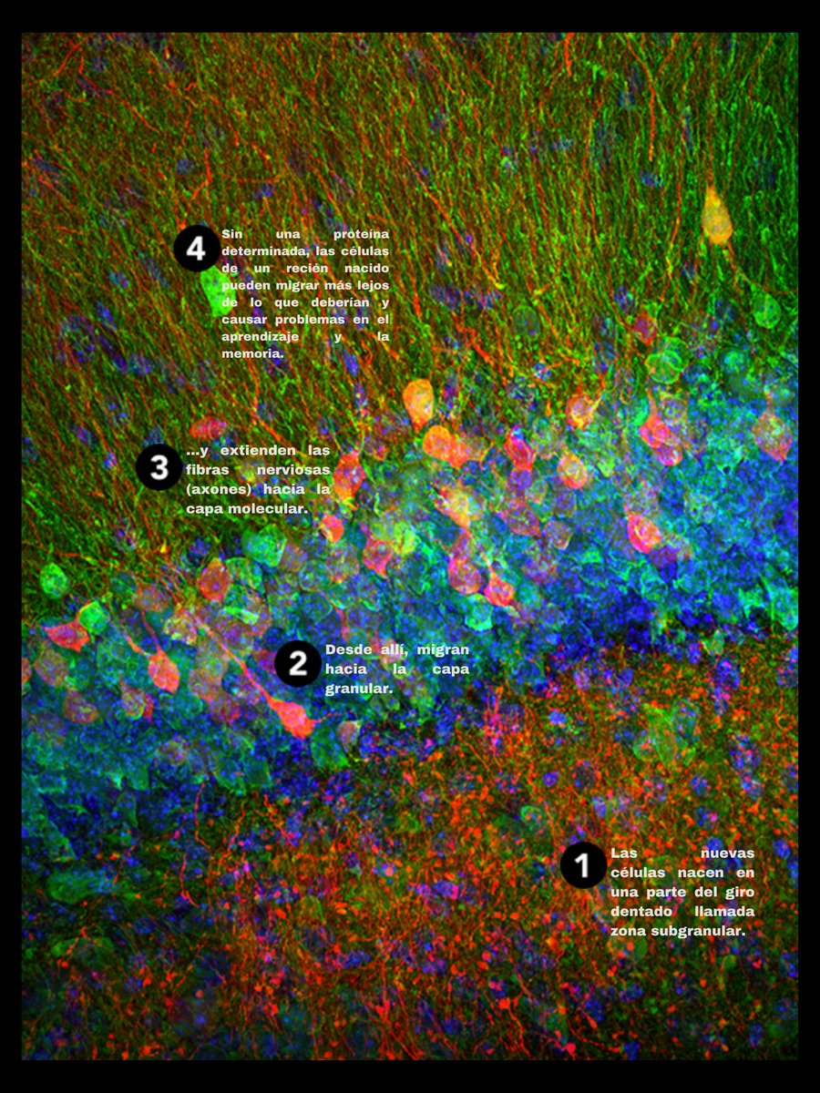 SfN_cdmx's tweet photo. ¡#MartesDeBrainFacts! 
Neurogénesis🧠🔬
Durante décadas los científicos creyeron que el cerebro era incapaz de crear nuevas neuronas. Hoy en día, sabemos que la neurogénesis –el nacimiento de nuevas células– puede ocurrir a lo largo de la vida... https://t.co/qhoOlO2O36