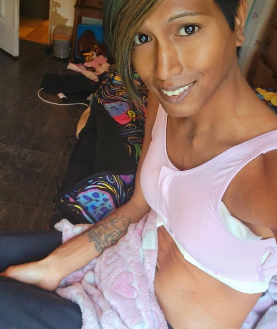 Can't wait to unveil the girls ?
#topsurgery #postop #hrt https://t.co/N37KbpezIH
