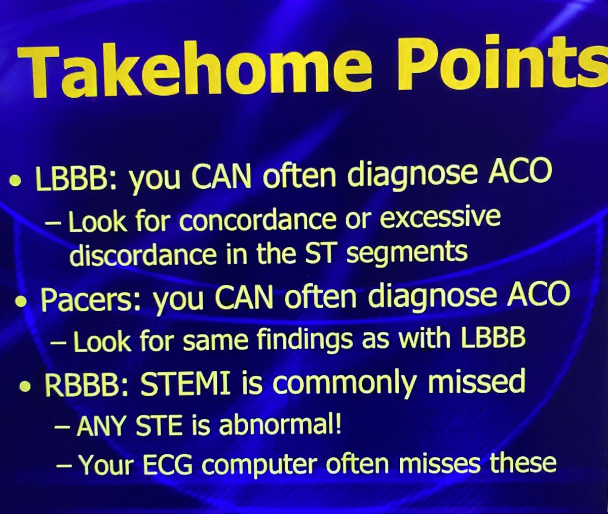 Great talk by @amalmattu to @EMUofT. 1) STEMI criteria misses many Acute Coronary Occlusions. 2) @smithECGBlog’s Modified Sgarbossa Criteria can identify ACO in LBBB and ventricular paced rhythms. 3) RBBB produces anterior STD so ACO can produce relative STE that is STEMI(-)