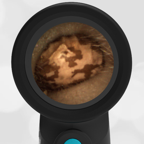 WiscMedWispr's tweet photo. Foreign Body: Pinto Bean https://t.co/SgANiGa64z #ear #foreignbody #pediatrics #ERPeds #ACEP #AAP #Otolaryngology #otoscopy #ENT #WiscMed #Wisprdigitalotoscope https://t.co/0XMsOdkDXr