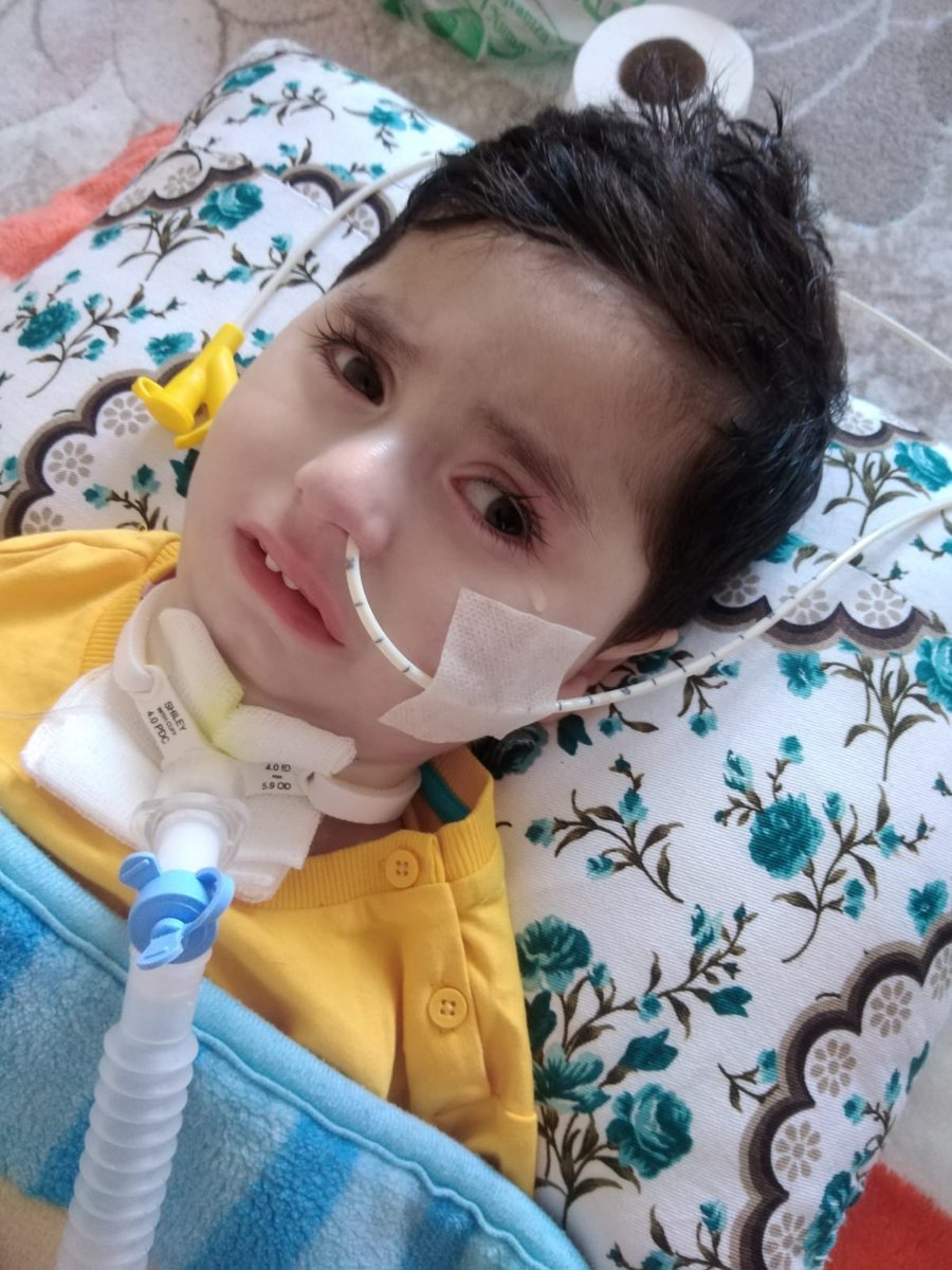 29 aylık Abdullah 5 gündür yoğun bakımdan lütfen hep birlikte  Abdullah'ın  çıkmayan sesi olalım 
#devalueasyon
#ErkenSecim
#sokağa
#DevletiminYanindayim
#tlyesahipcik #ERKENSECİM #OEğretmenlerGuenue #huekuemetistfa #EkonomikKurtulusSavasi #sma