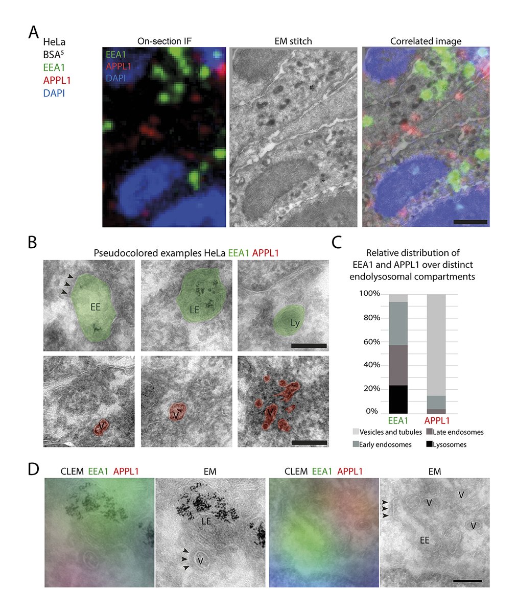 JCellBiol's tweet photo. A quantitative CLEM method by @JA_Beek, de Heus, @NalanLiv &amp; @JKlumperman determines the ultrastructural distribution of Rab5, Rab7, EEA1, APPL1 &amp; PI(3)P, revealing distinct endosomal subpopulations &amp; an unexpected localization of EEA1 to late #endosomes https://t.co/FnMmsUcic9 https://t.co/KfDfrl6PC7