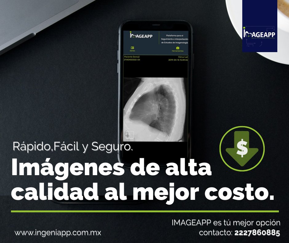 IngeniappC's tweet photo. IMAGEAPP suministra soluciones tecnológicas, actualizando e innovando en la atención e interpretación de estudios, y administración de recursos a hospitales, clínicas y centros de imagenología. 
 #RisPacs #Radiologia #DICOM  #ArchivoClinico #Administración #HInterpretacion https://t.co/rBw6H2zR6K
