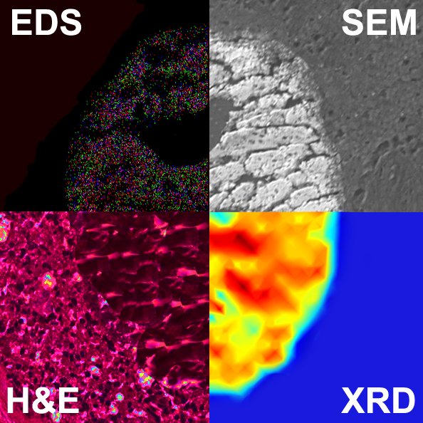 Histological staining (H&amp;E), scanning electron microscopy (SEM), elemental analysis (EDS) and X-ray diffraction (XRD) images highlighting the morphology and physicochemistry of a breast microcalcification. Read more at cord.cranfield.ac.uk/articles/figur…

#breastcancerresearch #science