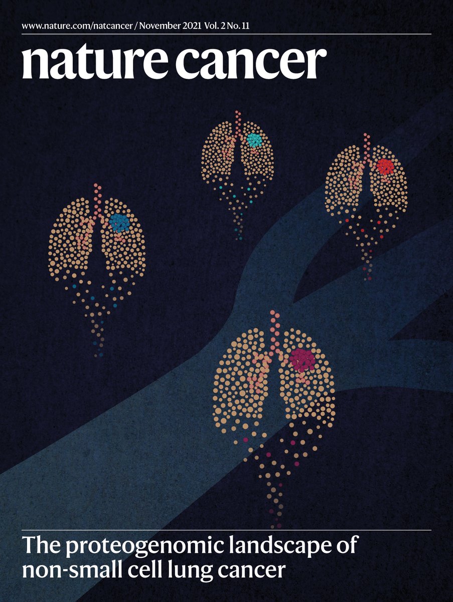 NatureCancer's tweet image. 🍂🌰🥧 Our November issue @NatureCancer IS LIVE!

This month, read about RT and #Immunotherapy trials, #PancreaticCancer, macrophages &amp;amp; GBM therapy, SCC stemness, AML #metabolism and #therapy, #proteogenomics of lung cancer &amp;amp; much more!

DON'T MISS IT! 👇
go.nature.com/3nCuDxA