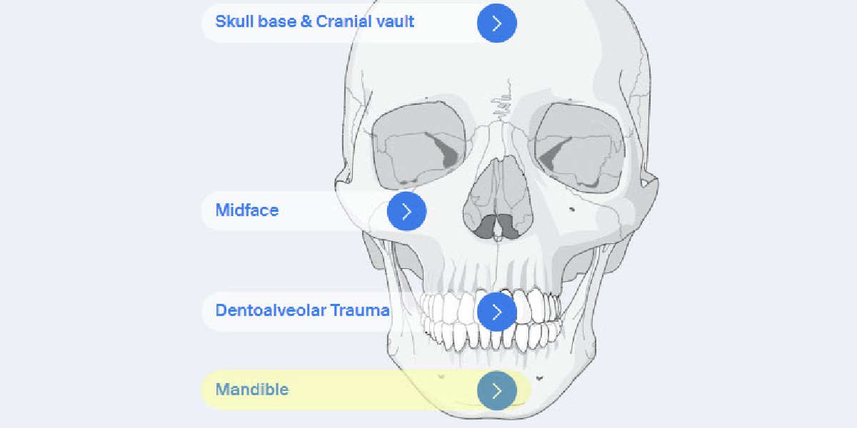 AOFoundation's tweet photo. 📢 New revised material now online on AO Surgery Reference
Check the mandible module here ➡️ https://t.co/SLiRMnZEpo   

#surgeryreference #mandible #mandibularfracture #surgery https://t.co/VmuZR0JSnT