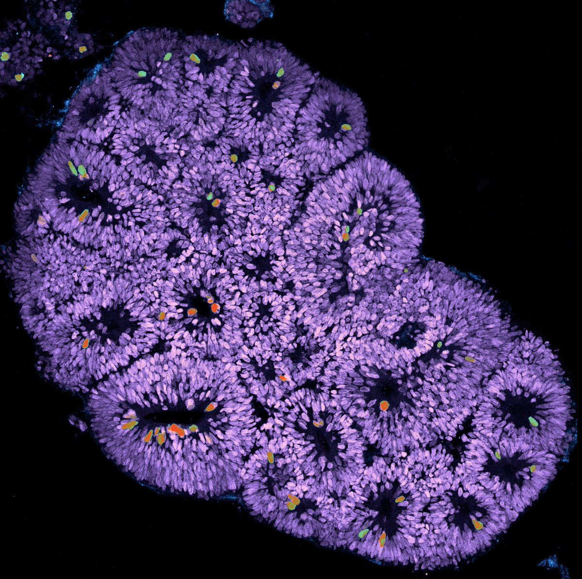 A few weeks ago, we (<a href="/Dykeywykey1/">Emma D</a>, Rachel Mijdam, and myself) had 2 eventful 16+ hour days of organoid making in the @naelnadif lab, as a product of our efforts, here is a 10 day old cerebral organoid.