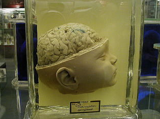 teoyleo's tweet photo. Hay videos divulgativos que aunque pasen muchos años no se devaluan, sino todo lo contrario. Este es el caso de un documental muy interesante acerca del cerebro del bebé de Eduard Punset. Os lo recomiendo ver 👇
https://t.co/z1xm6XqinC https://t.co/85oYivgr8X