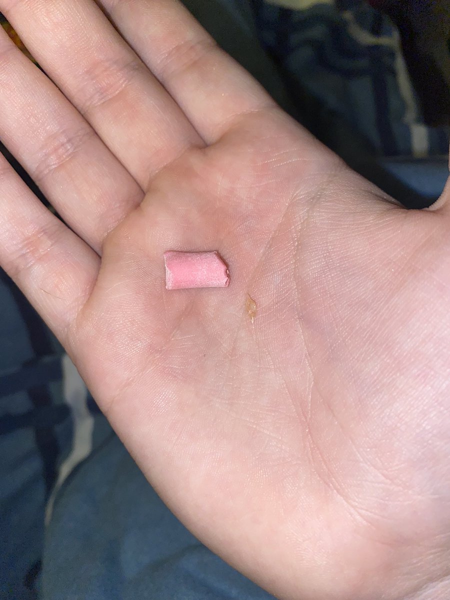 spicysadhours's tweet photo. just found something like literal glass in my candy ๐ธ #lookolook https://t.co/F8kfaREVSF