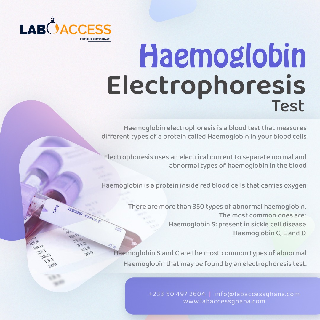 lab_access's tweet image. Lab testdigest!
Do you know your haemoglobin genotype?

#haemoglobinelectrophoresis 
#labtests 
#labaccess 
#medicallaboratory 
#mobilelaboratory