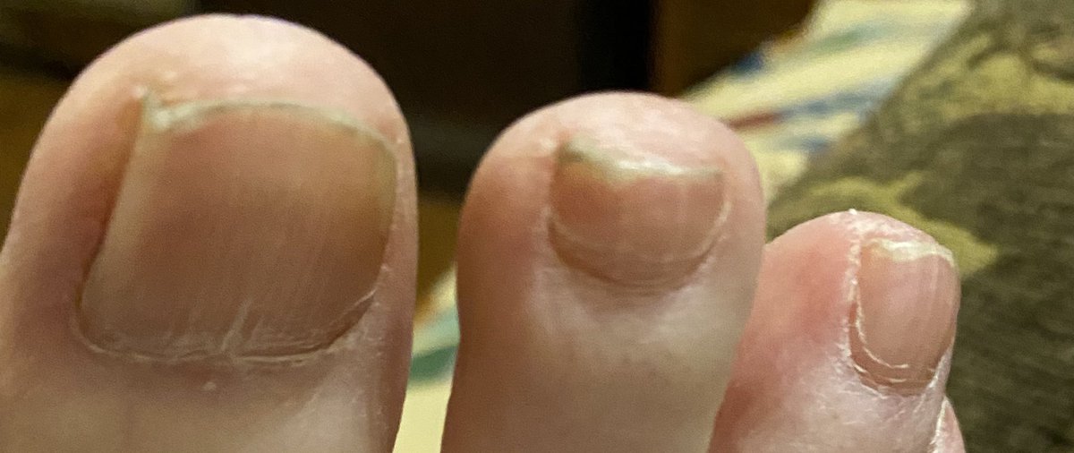 becpentland's tweet photo. Iโm so sorry to subject you all to my ugly as F($& #dirtytoenails white toenails. Seriously! If anyone told me last week that I would be posting a pic of my ugly A@@ toes I would say ur Crazy!! #AhmaudArberyTrial #AhmaudArbery since when did pedicures become a law??? https://t.co/Y6lOzzlhSF