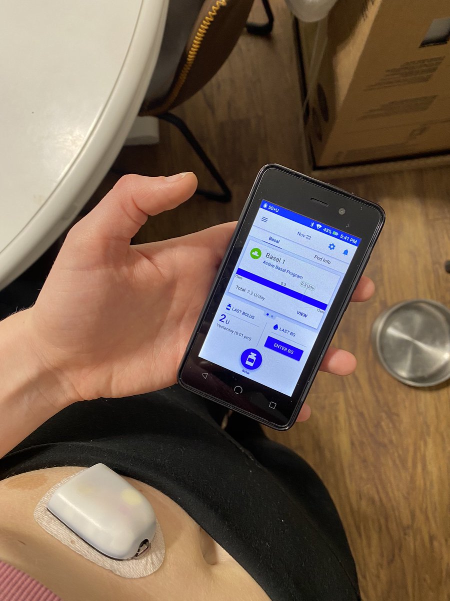 elrod_abby's tweet photo. ever wonder what it’s like to have an electronic pancreas ? https://t.co/LSd2IKw0Nx
