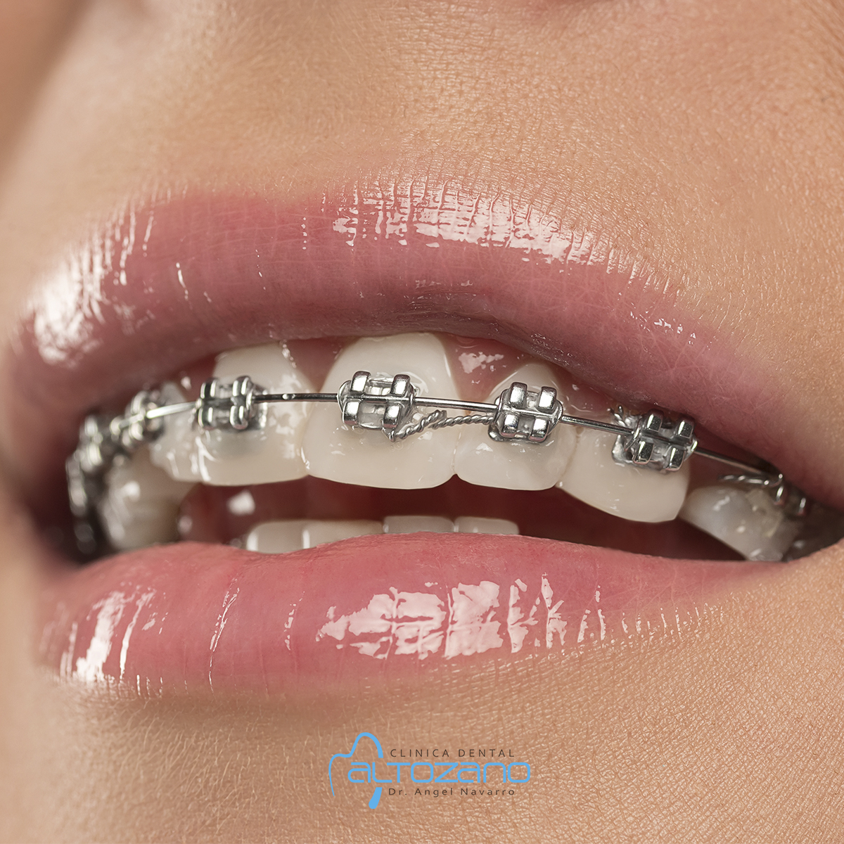 Geografía Marcar desconcertado colores para los brackets familia real