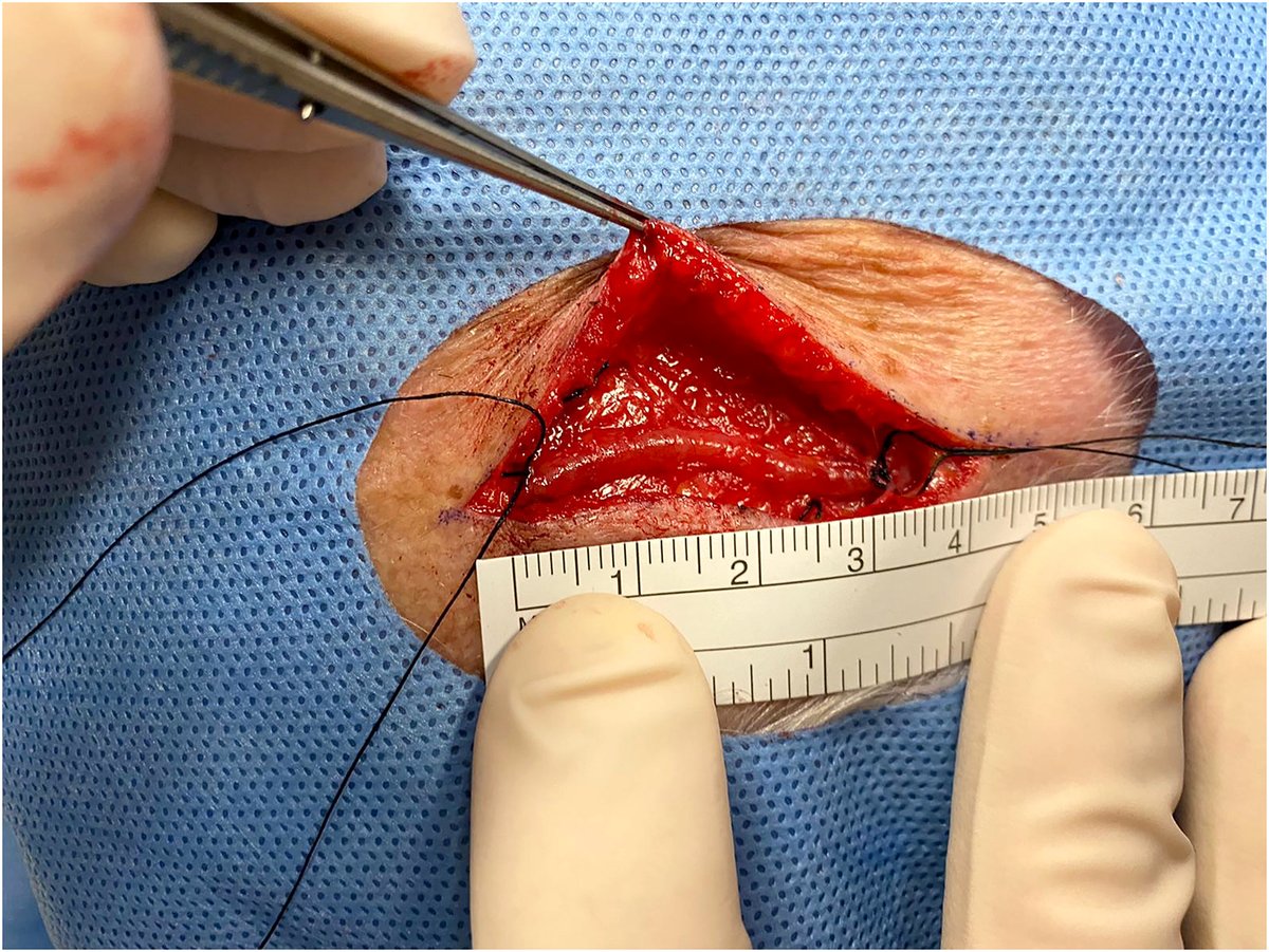 ClinExpOphthal's tweet photo. Diagnosis and management of giant cell arteritis: A major review. From our 2021 special issue on 'The Eye and Systemic Disease' #giantcellarteritis #temporalarteritis
https://t.co/jbC3gObqXN https://t.co/o5RtveF2mX