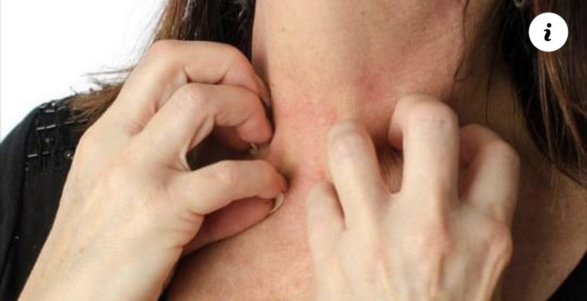 SCoopNewsOff's tweet photo. Une femme a failli mourir d’une allergie au sperme https://t.co/5EoEQFwjcv