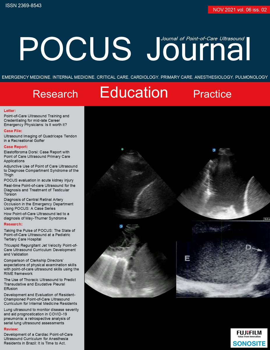 POCUS Journal Vol 6 Iss 2 is now available online! Read it here: pocusjournal.com/issue/vol-06-i… #POCUSJournal #POCUS #FOAMed @amerjohri @DrGalenMD