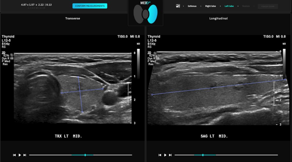 TeriMSippel's tweet photo. Visit @Medo_ai in the RSNA Imaging AI in Practice Demo to watch AI perform the tedious tasks of identifying and measuring US thyroid nodules and see how those results can be adjusted and confirmed in the PACS.  South Hall 4925  #RSNA21 #RadAI #ImagingAI @RSNA @IHEIntl https://t.co/mVmsoHnKq5