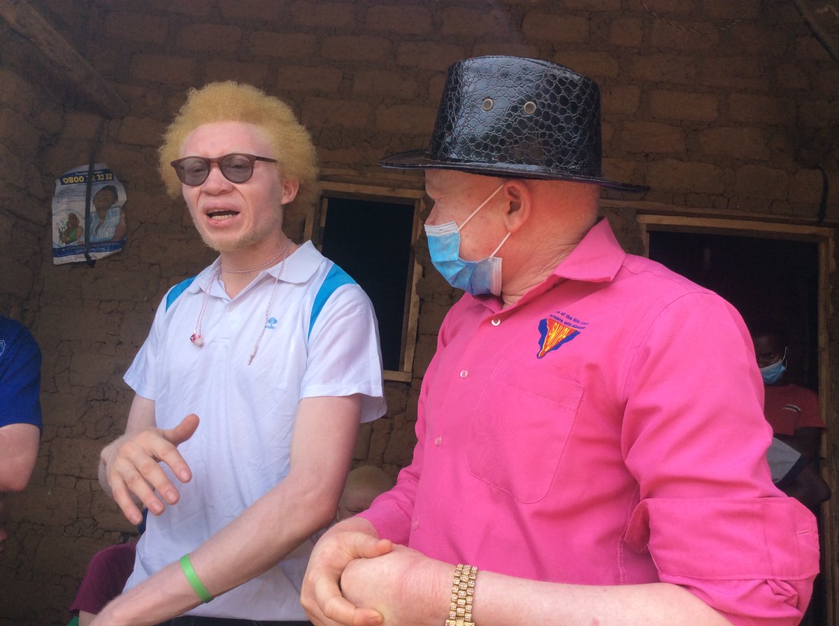 AlbinismNews's tweet photo. We had a life transforming journey to #RwamwanjaRefugeeSettlement
Camp over the weekend for a medical camp for our brothers and sisters with albinism. #Larubi https://t.co/PG8a6bpRtv