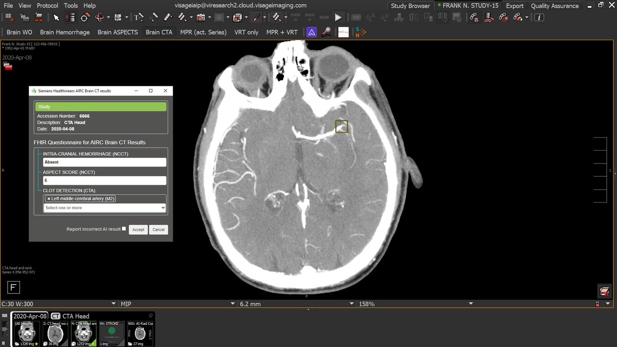 TeriMSippel's tweet photo. Visit @Visage_Imaging in the RSNA Imaging AI in Practice Demo to see AI results integrated into daily clinical practice. See AI results confirmed, edited, or deleted directly on the Visage PACS system. South Hall 4925 #RSNA21 #RadLex #CDE #RadAI #ImagingAI #IHE @RSNA @IHEIntl https://t.co/xg9FfnTr8q