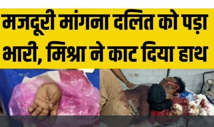 AsjadShanu's tweet photo. Demanding wages was heavy for the dalit, Mishra cut his hand
Very heartbreaking
 Ganesh Mishra should be punished soon.
 #दलित_का_हाथ_क्यों_काटा
@KotwalMeena @Mmeenajohar @ManojMehtamm @NargisBano_ @Champarni_Tariq @kaushikrj6 @aiparisangh @Dr_Uditraj @HayaKhan999 https://t.co/YUCywDTo4h