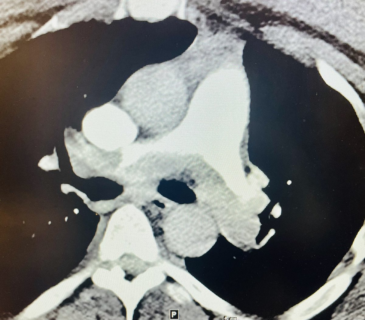 Robert A Lookstein MD, MHCDL tweet media