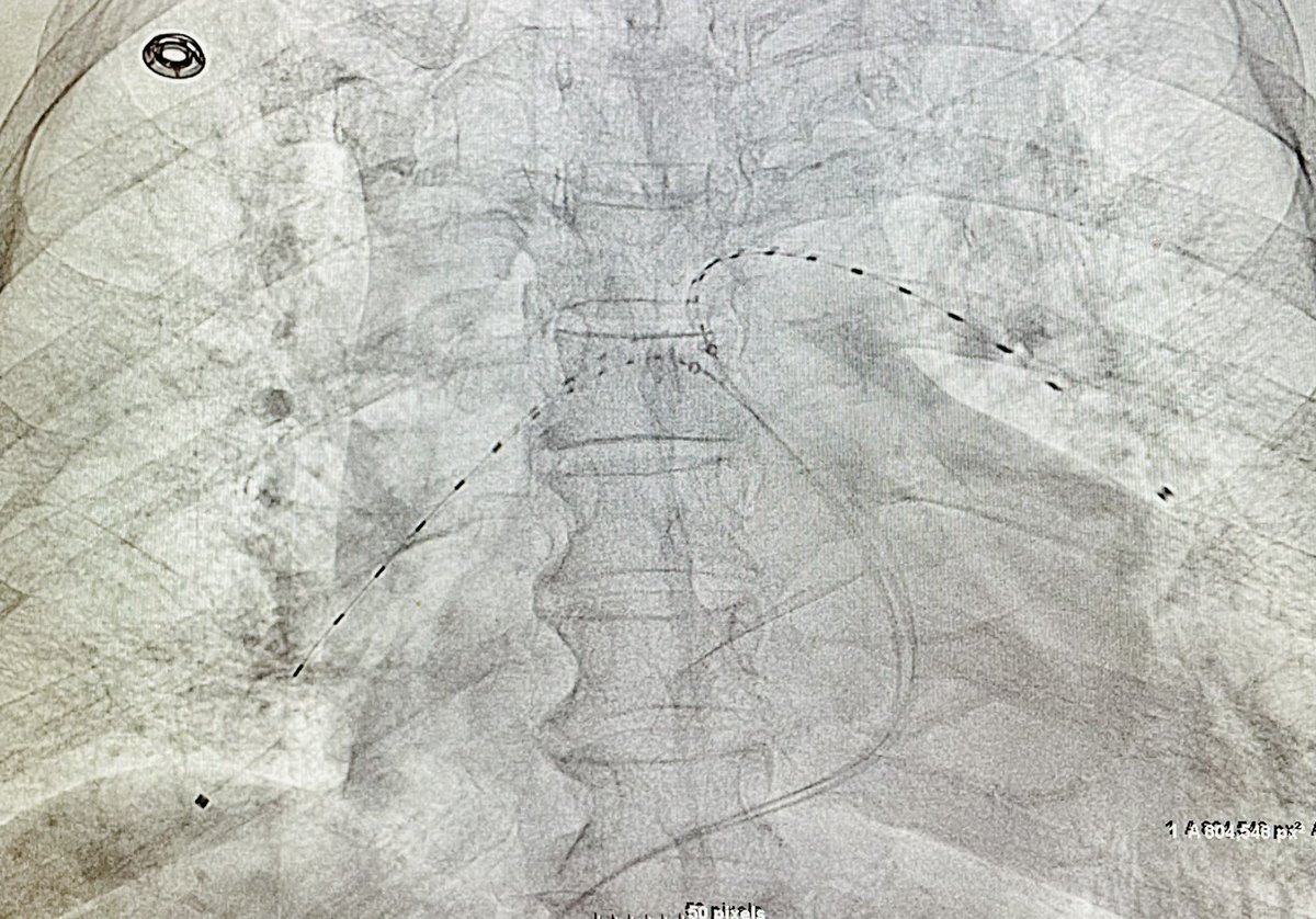 Robert A Lookstein MD, MHCDL tweet media