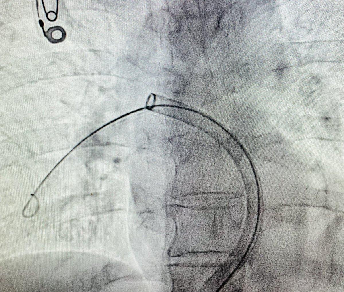 Robert A Lookstein MD, MHCDL tweet media