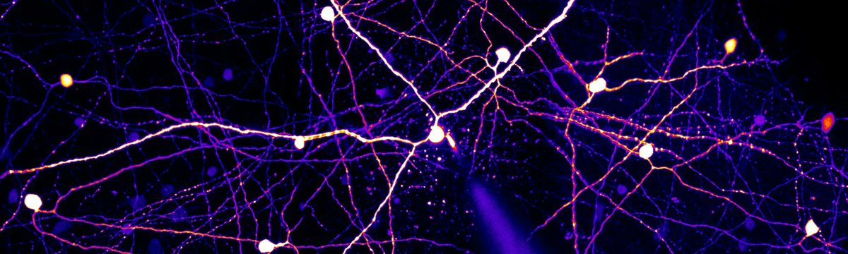 Scientifica_Int's tweet photo. Here, @Nouronal breaks down the steps of patch clamp recordings and what can go wrong at each stage, with some advice for troubleshooting to ensure your experiments go smoothly. #neuroscience #science #electrophysiology #patchclamping
https://t.co/iysALwbfRw https://t.co/dqHmi8Vaus