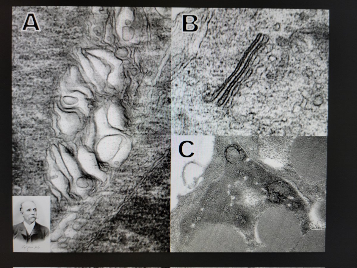 Findlay_Venom's tweet photo. "The many faces of Golgi"
Unfortunately I had to borrow the image of Camillo himself https://t.co/uocWZSGap8
