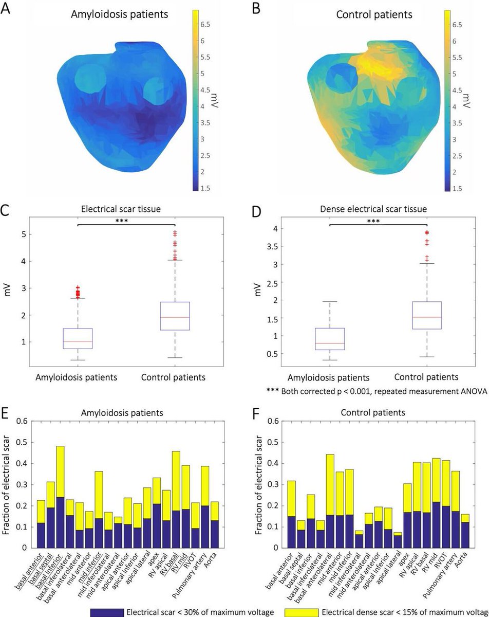 Heart_BMJ's tweet photo. Machine learning-derived electrocardiographic algorithm for the detection of cardiac amyloidosis

https://t.co/tVaWzt8udM https://t.co/RxvYk03z7B