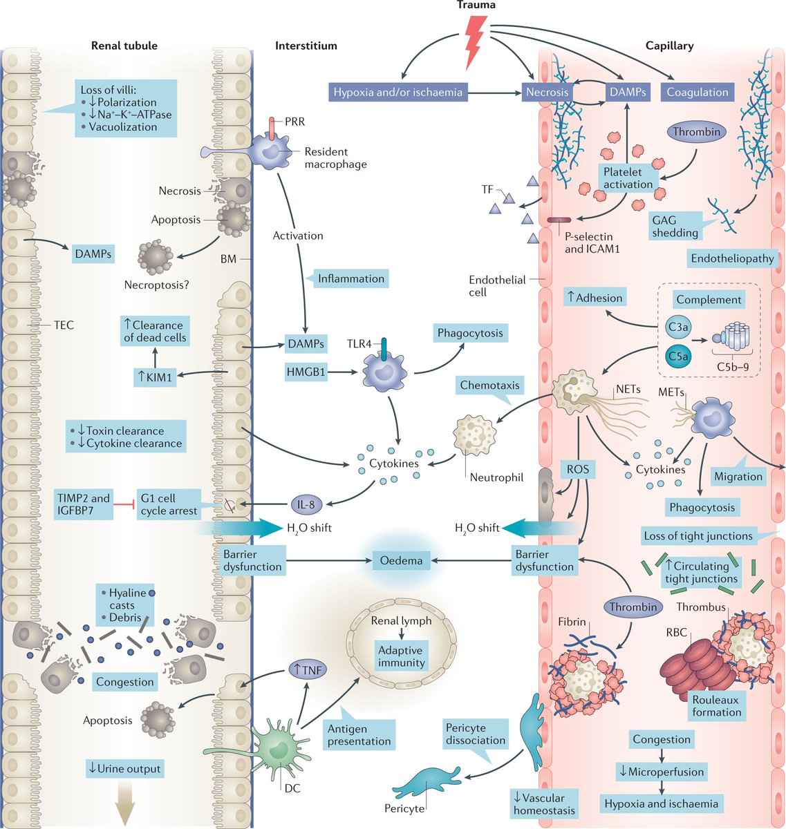 NatRevNeph's tweet photo. Innate immune response in the tubular system during trauma-related AKI.
 
https://t.co/XybIheULQf https://t.co/pcYZAfSriv