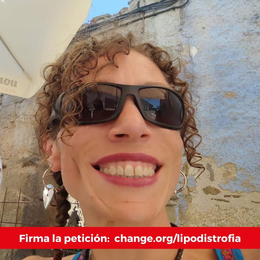 beatrizce78's tweet photo. Mi amiga Elena nació con lipodistrofia total congénita, síndrome de Berardinelli Seip.
La esperanza de vida de su enfermedad es de 20-25 años.  Cuando tenía 23 entró en el ensayo clínico con metreleptina que salvó su vida, cuando pensábamos que no nos quedaba ni la esperanza.🧵 https://t.co/U7oSSew4De