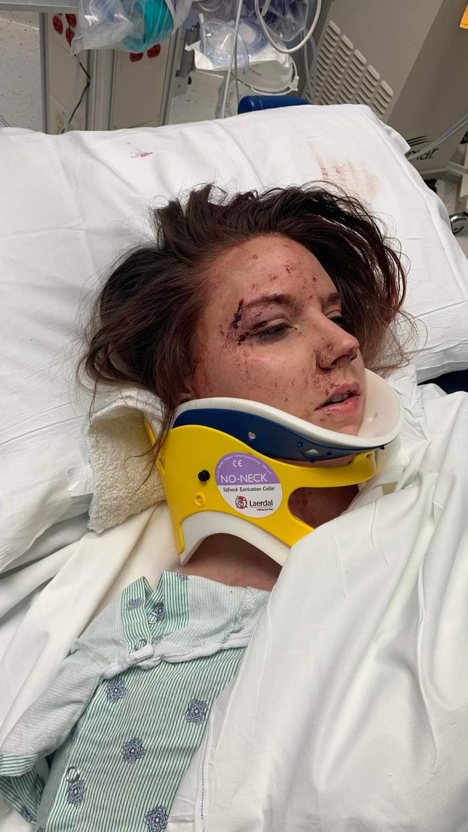 PerryRaegan's tweet image. Didnt die from drugs didnt die from a wreck. 16 staples to the head and i am lucky to be alive.