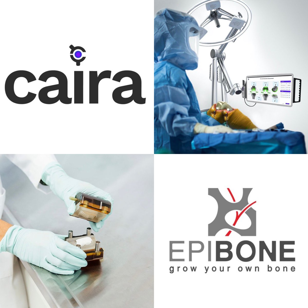 PeterCoffaro's tweet photo. Top #MedTech Startups in 2021 ๐
โก๏ธ Caira Surgical
#RadarTracking #SurgicalNavigation #RoboticSurgery #JointReplacements
โก๏ธ @EpiBoneInc
#Biotechnology #BoneGraft #RegenerativeMedicine #orthopedics #orthopaedics
https://t.co/8k6IhjgtBl https://t.co/uHLkIDw2lu