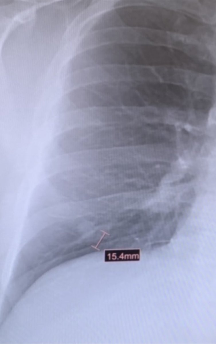 Adult in the room tweet media