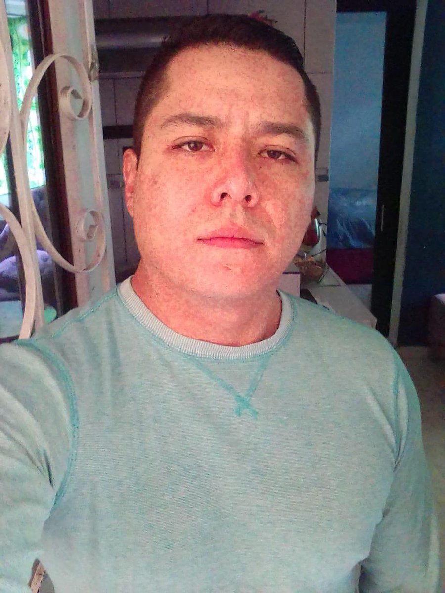 LaRealidadenMx1's tweet photo. Pese a golpiza y tortura que le propinaron policías de @UCS_GCDMX  @SSC_CDMX a Martín Martinez Lugo, este sigue  detenido en #GAM4 x supuesto ROBO sin indicios
Familiares piden intervenga @ErnestinaGodoy_ @FiscaliaCDMX @c4jimenez https://t.co/hjN1syL5uG
