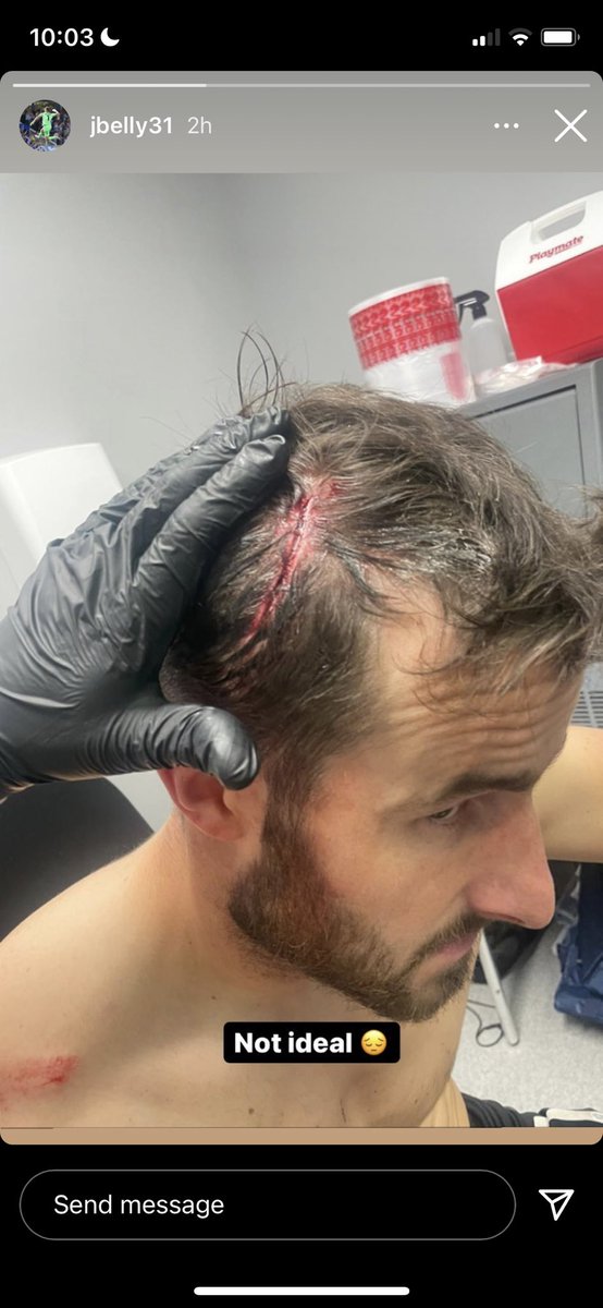 Benji_Deane's tweet photo. Not a red card 🤯🤯🤯 https://t.co/VKwfmjB3MR