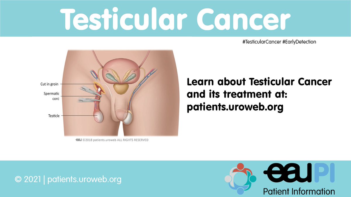 EauPatient's tweet photo. As #TesticularCancer grows, you might feel a lump or swelling in part of one testicle. This is the most common symptom. So, #CheckEmLads as #EarlyDetection is key.

Know more:
💻https://t.co/KdYcXNcomx
🖨️https://t.co/QiaJC0D7qq

#Movember2021 #MensHealth @Uroweb @EAUNurses https://t.co/ilhzTZvvo5