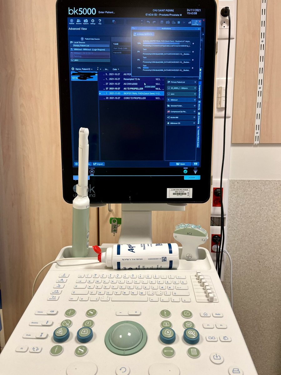 Urology_Fadi's tweet photo. Preparing for the next sessions of 🎯 #fusion_biopsy of the #prostate using the @Uro_bkmed bk5000 

#urotweet #MedTwitter #ProstateCancer 

@ChuSaintPierre https://t.co/E1M1O0HqZ1